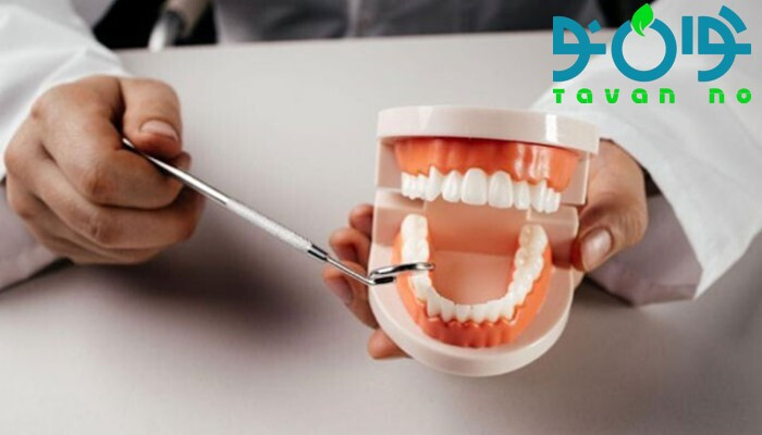انواع بیماری های دندان پزشکی